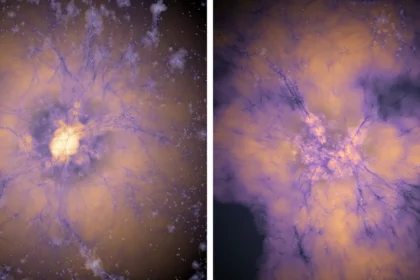 Early dark energy could resolve cosmology’s two biggest puzzles