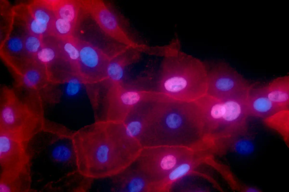 Startup provides real-time view of breast cancer during surgery