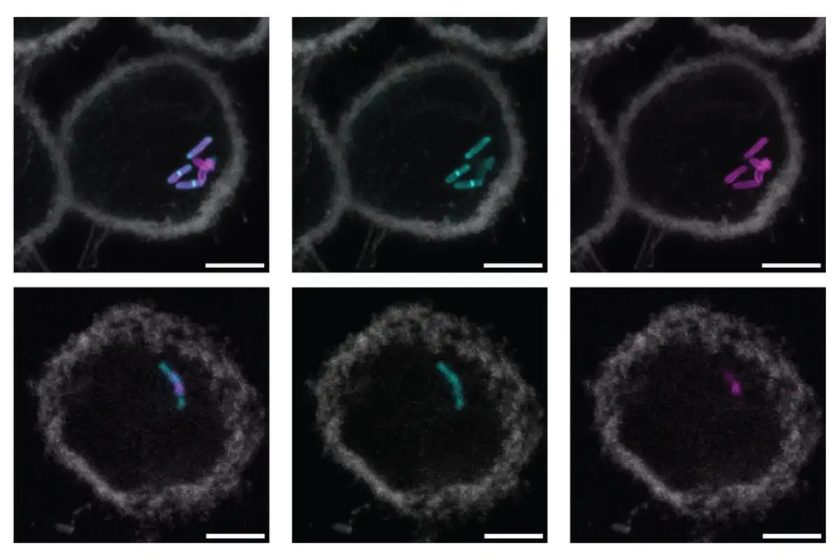 Molecular label simplifies and speeds up tuberculosis testing