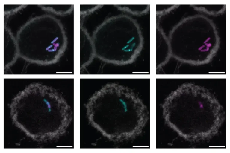 Rótulo molecular simplifica e acelera o teste de tuberculose