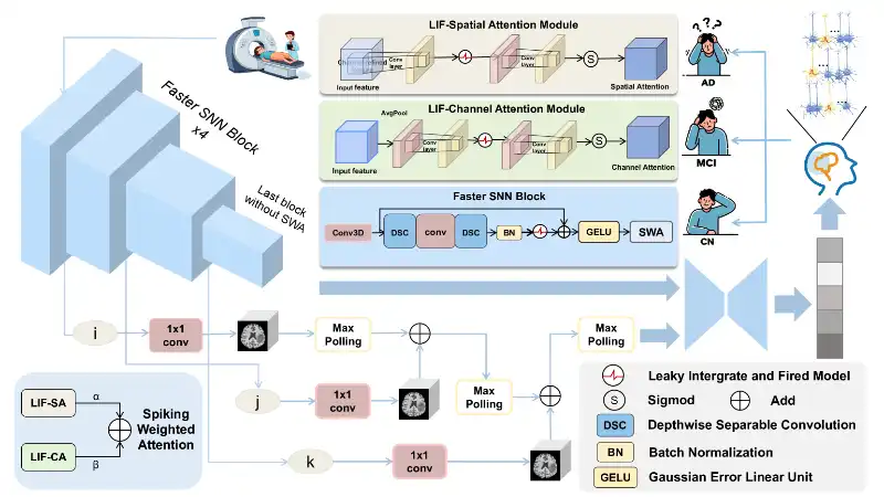 AI Model Promises Revolution in Alzheimer's Diagnosis