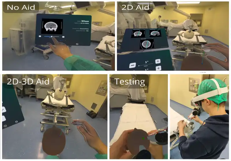 Study tests effectiveness of mixed reality in neurosurgery.