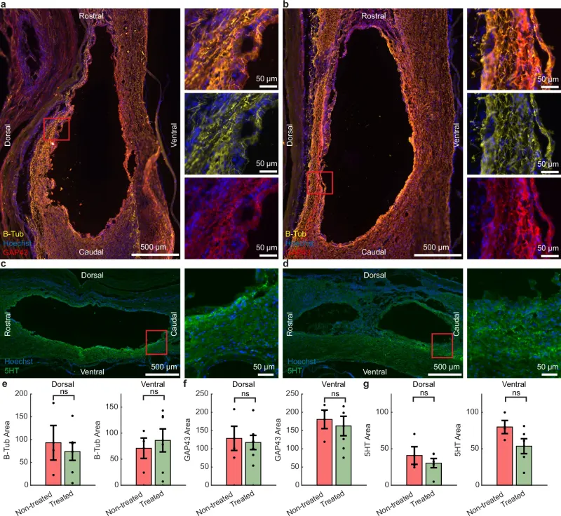 Comparação entre os grupos tratado e não tratado mostrou níveis semelhantes de densidade axonal e marcadores de regeneração, indicando que a recuperação funcional pode estar ligada a outros mecanismos além do crescimento de novos axônios.