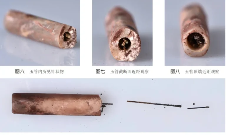 Discovery Reveals the World's Oldest Acupuncture Needles.