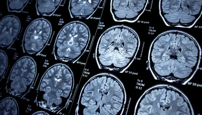How Your Brain Decides to Keep Going or Give Up