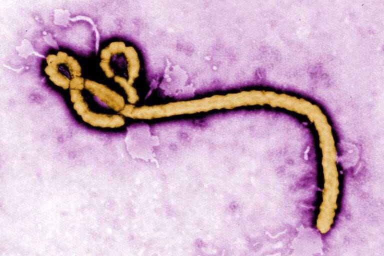 Researchers used an image-based screening method developed to identify human genes that, when silenced, impair the Ebola virus’s ability to infect. These viral regulators could represent avenues to one day reduce the severity of disease in people infected with the virus.