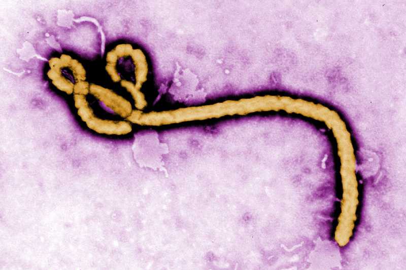 Researchers used an image-based screening method developed to identify human genes that, when silenced, impair the Ebola virus’s ability to infect. These viral regulators could represent avenues to one day reduce the severity of disease in people infected with the virus.