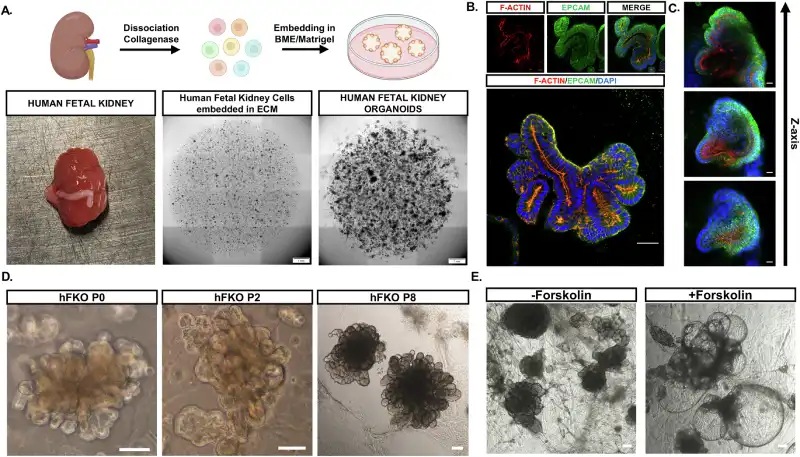 Establishment of the protocol for generating hFKOs (human fetal kidney organoids). (A) Top: schematic representation of the process of dissociation, incorporation, and cultivation of hFK cells (human fetal kidney cells) to form hFKOs. Bottom left: human fetal kidney before cutting and dissociation. Bottom center: wide-field image of basement membrane extract (BME) droplets containing hFK cells immediately after dissociation. Bottom right: hFKOs emerging after 2–3 weeks of culture. Scale bars: 1 mm. (B) Staining for actin (red, present in microvilli) and EPCAM (green, general epithelial marker) reveals polarized renal epithelium, similar to the original fetal kidney. Scale bars: top, 20 μm; bottom, 50 μm. (C) Complex luminal networks detected by confocal microscopy. Scale bars: 50 μm. (D) hFKOs cultured in hNPSR (a culture medium specific for human renal progenitor cells) through several passages, shown at P0 (2–3 weeks after incorporation and culture, n = 28), P2 (n = 15), and late hFKOs (P5–P6, P8, n = 3), displaying convoluted epithelium. Scale bars: 100 μm. (E) hFKOs increase in volume in response to supplementation with 25 μM forskolin in hNPSR medium. Scale bars: 100 μm.