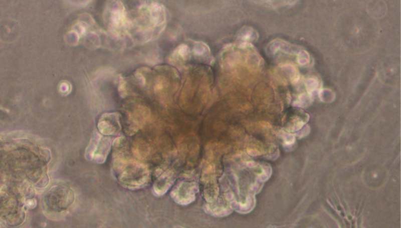 Scientists grow pure, stable human mini-kidneys for the first time