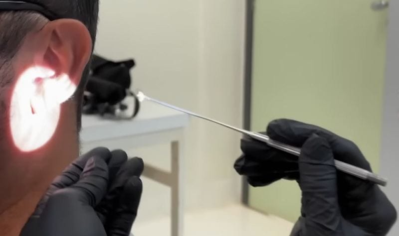 Brazilian university research finds that earwax can help detect cancer