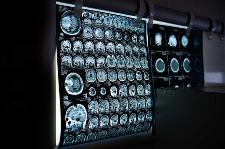 MIT researchers have developed a new AI-based tool that rapidly annotates areas of interest in medical images and can help in the study of new treatments or map disease progression.