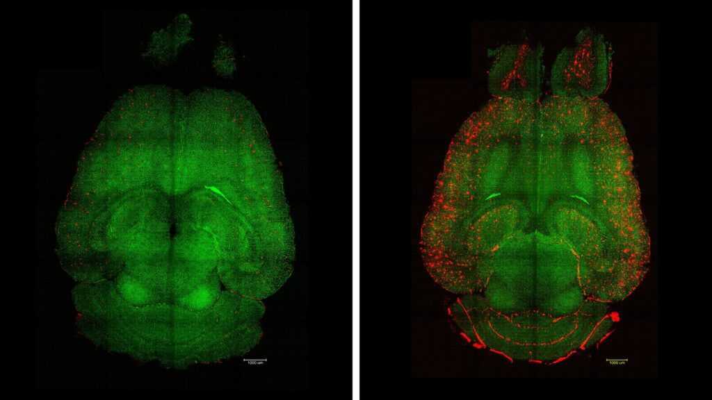 Fluorescence microscopy images of thin brain sections from mice 12 hours after being treated (left) or untreated (right) with nanoparticles. The brains were analyzed to assess Aβ plaque accumulation. Red: Aβ plaques. Green: blood-brain barrier vessels.