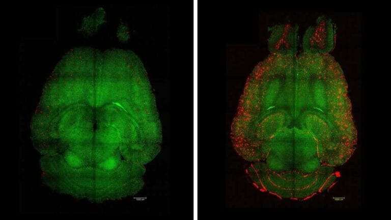 Imagens de microscopia de fluorescência de lâmina fina de cérebros de camundongos 12h após serem tratados (esquerda) ou não (direita) com nanopartículas. Os cérebros foram analisados para observar a quantidade de acúmulo de placas de Aβ. Vermelho: placas de Aβ. Verde: vasos da barreira hematoencefálica.