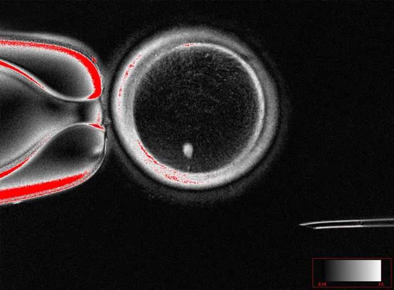 Óvulo contendo núcleo de célula da pele humana, antes da fertilização.