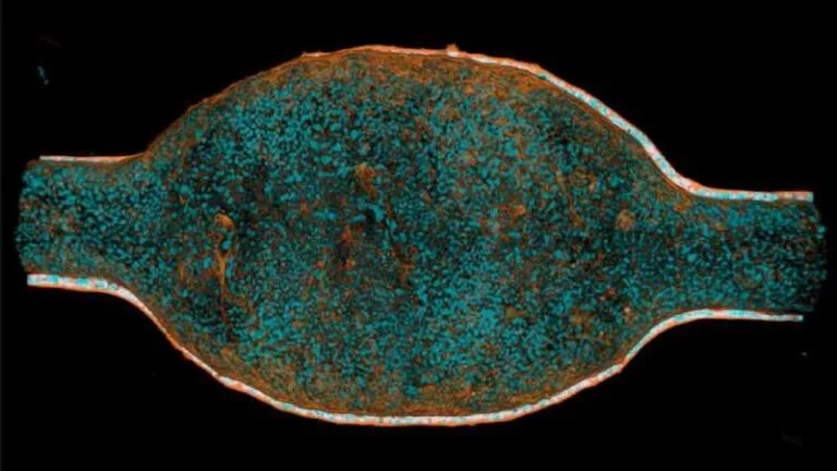Z-stack animado mostrando o volume de uma mini-bexiga diferenciada corada com faloidina (laranja) e DAPI (ciano). Crédito: Paduthol et al., 2026.