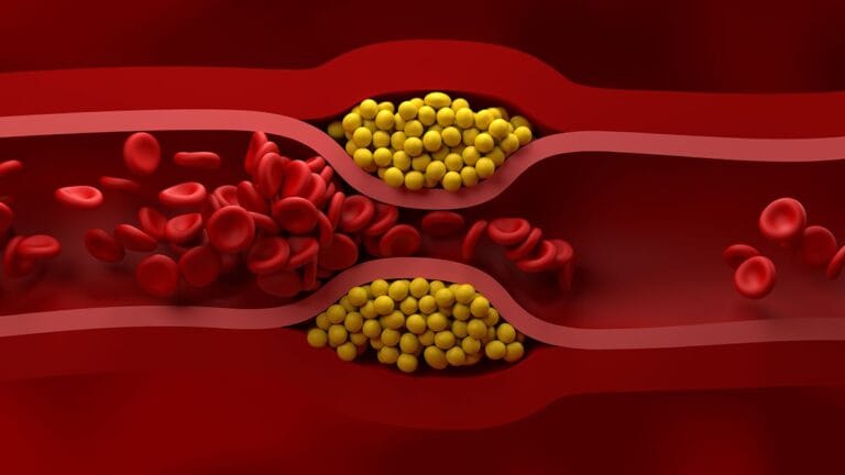 Novas Diretrizes de Cardiologia dos EUA: Gerenciamento de Colesterol e Prevenção Cardiovascular