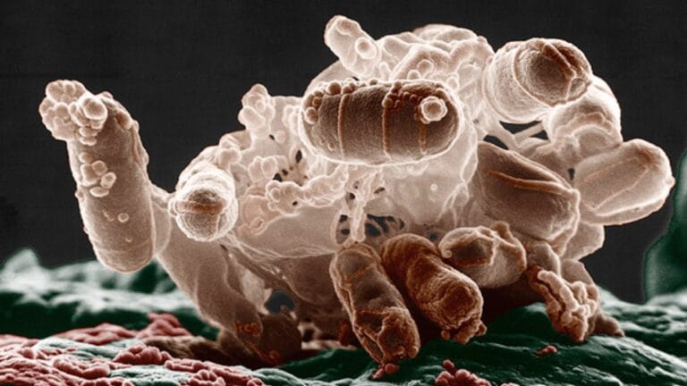 Antibióticos Podem Aumentar Inflamação em Infecções