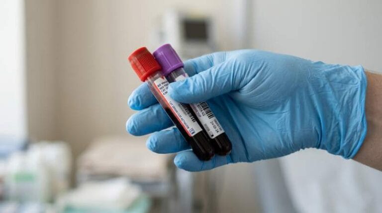 Exame de Sangue Pode Indicar Risco de Alzheimer Anos Antes dos Sintomas