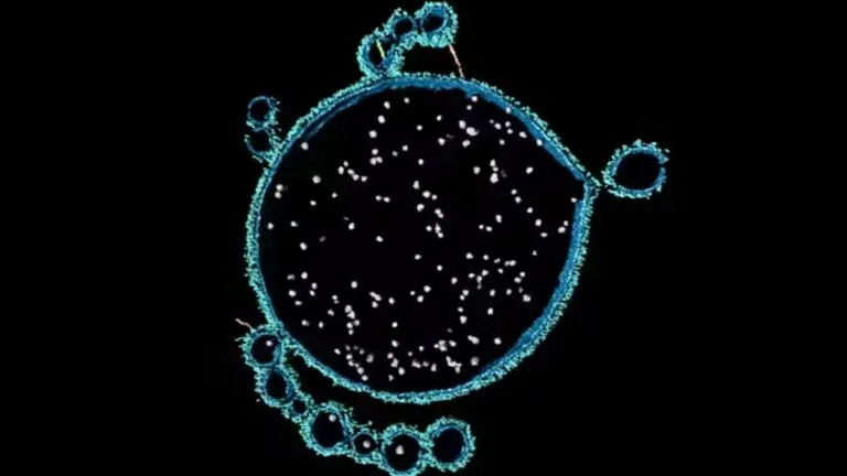 Imagem microscópica de um arqueano Asgard recém-descoberto (Nerearchaeum marumarumayae), derivado de mantos microbianos, oferecendo pistas sobre a formação da vida complexa. (Debnath Ghosal)