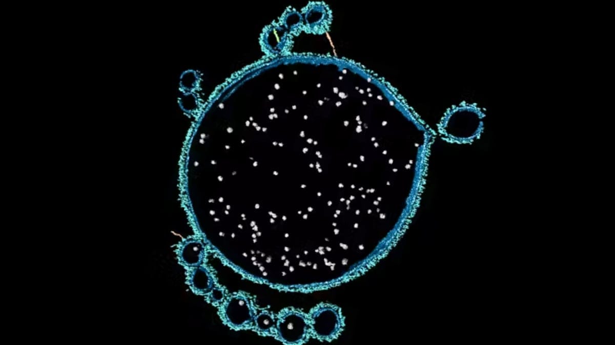 Imagem microscópica de um arqueano Asgard recém-descoberto (Nerearchaeum marumarumayae), derivado de mantos microbianos, oferecendo pistas sobre a formação da vida complexa. (Debnath Ghosal)