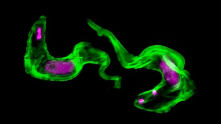 Cientistas Desvendam Mistério de 40 Anos do Parasita da Doença do Sono