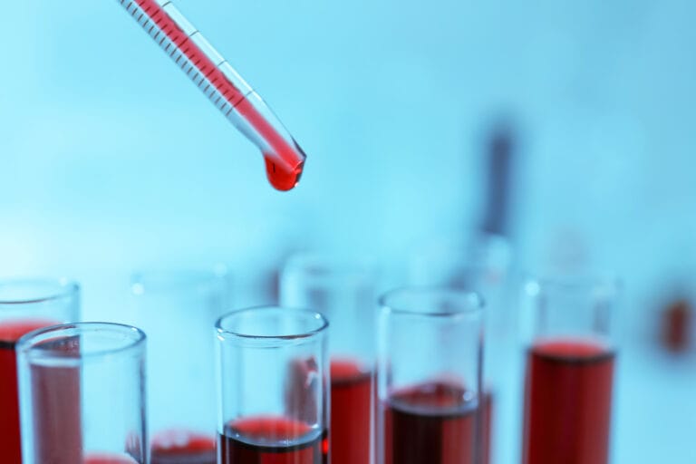 Universidade de Hong Kong cria teste de sangue preditivo de doenças cardíacas