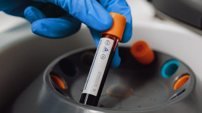 Estudo revela PFAS em 98,8% das amostras de sangue humano