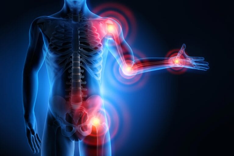 Estudo relaciona baixa vitamina D a dor pós-cirúrgica em câncer