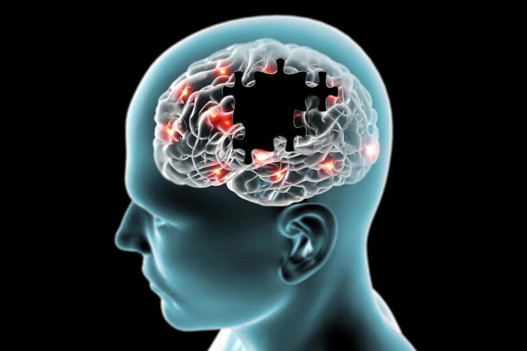 Estudo revela ligação entre obesidade e Alzheimer