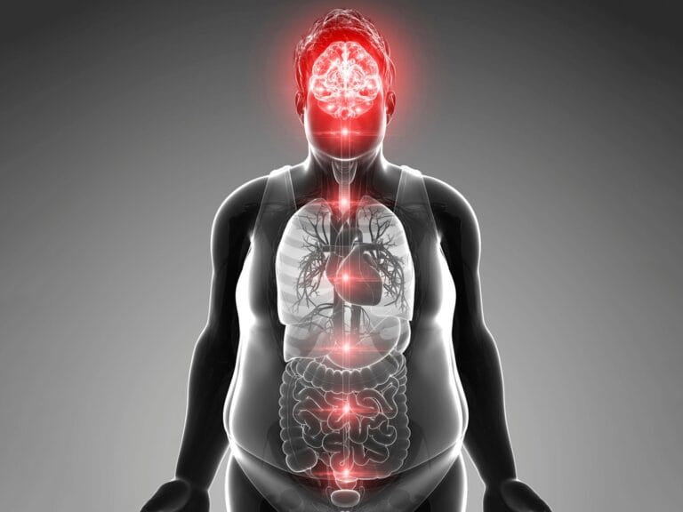 Estudo relaciona excesso de peso ao envelhecimento cerebral