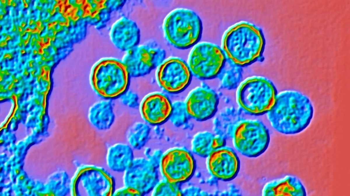 Colour enhanced transmission electron micrograph of Hantavirus particles
