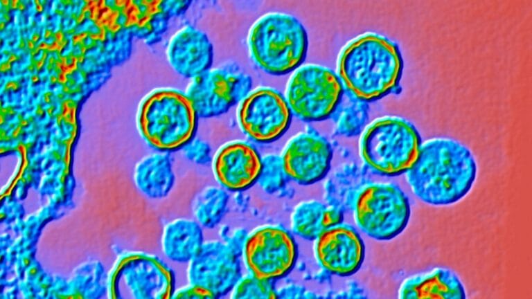 Micrografia eletrônica de transmissão com cores realçadas de partículas de hantavírus. (Alfred Pasieka/Science Photo Library/Getty Images)