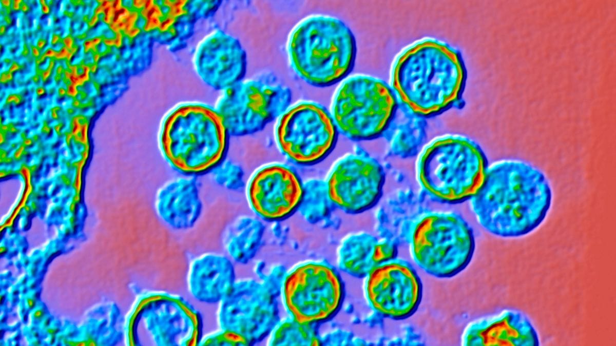 Micrografia eletrônica de transmissão com cores realçadas de partículas de hantavírus. (Alfred Pasieka/Science Photo Library/Getty Images)