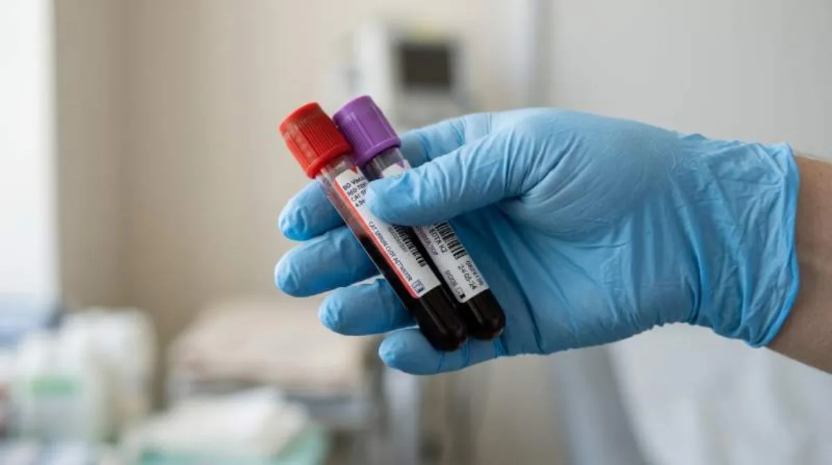 Estudo revela PFAS em 98,8% das amostras de sangue humano