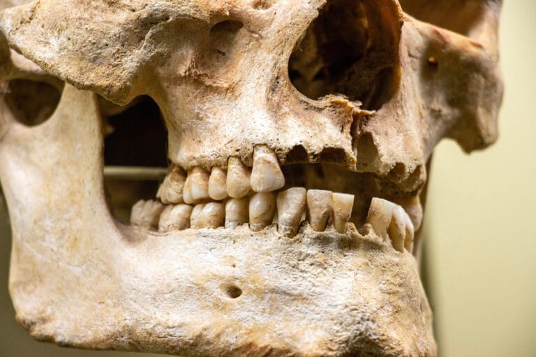 Dente de Neandertal de 59 mil anos revela tratamento dental