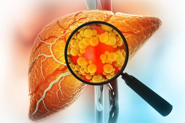 Formoterol pode reverter doença hepática gordurosa em humanos