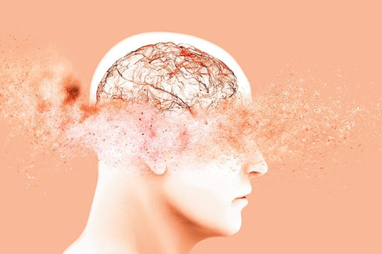 Cientistas identificam via cerebral que pode retardar Parkinson