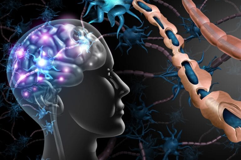 Estudo compara modelos de esclerose múltipla com tecido humano