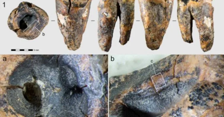 Chagyrskaya 64 molar showing the drilled cavity. Source: Zubova et al., 2026, PLOS One, CC-BY 4.0