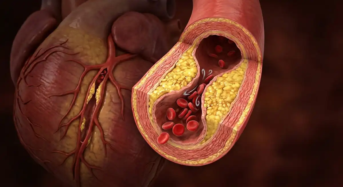 Um novo tratamento baseado em DNA bloqueia uma proteína chave que mantém o colesterol ruim elevado, ajudando o corpo a eliminá-lo de forma mais eficaz. Resultados iniciais mostram quedas significativas nos níveis de colesterol sem os efeitos colaterais típicos dos medicamentos padrão.