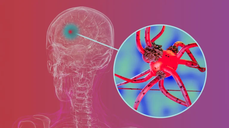 Pesquisadores bloqueiam proteína que ajuda na progressão do Parkinson