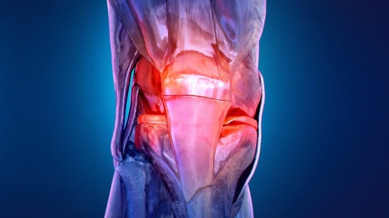 Tratamento de osteoartrite utiliza estimulação elétrica muscular