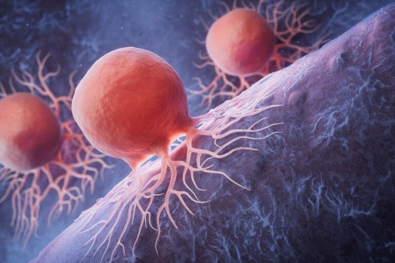 Estudo aponta nova estratégia contra câncer pancreático