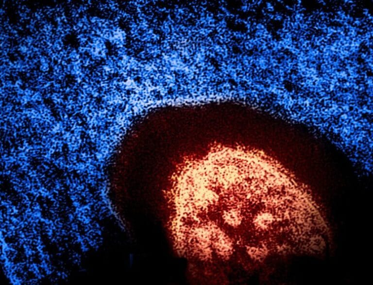 Cientistas identificam células T que combatem sarampo e Nipah