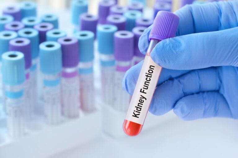 Estudo revela riscos ocultos em testes renais normais