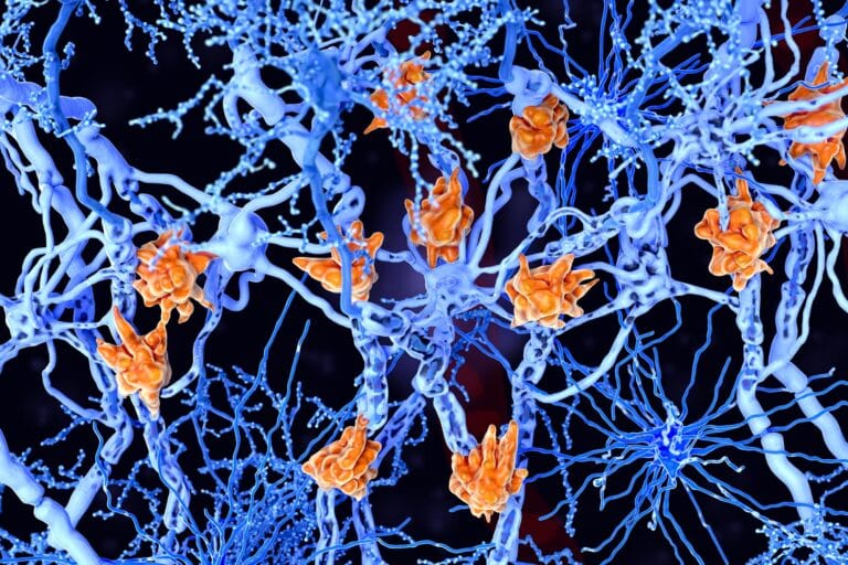 Estudo revela papel do intestino na esclerose múltipla