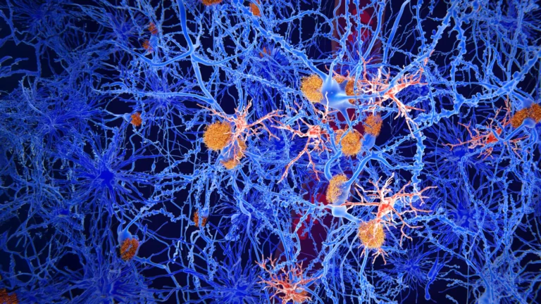 Pesquisadores reprogramam células imunes do cérebro contra Alzheimer