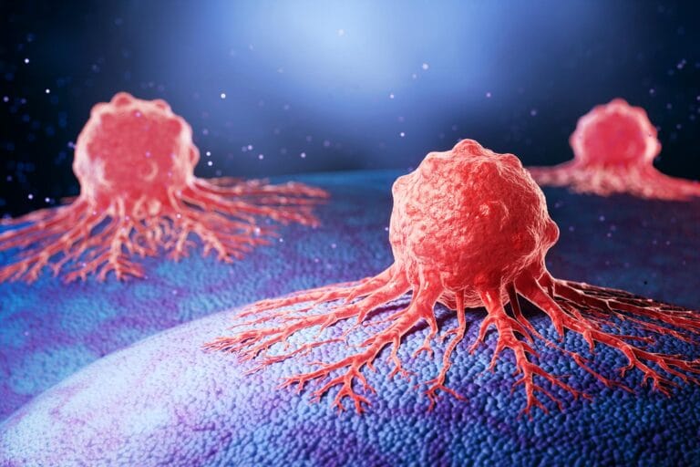 Pesquisadores identificam IL1RAP como alvo em câncer pancreático