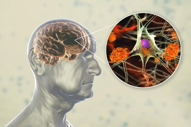 Estudo aponta que polifenóis podem apoiar envelhecimento cerebral