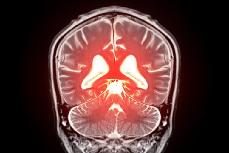 Estudo identifica proteína KLF4 ligada ao envelhecimento cerebral